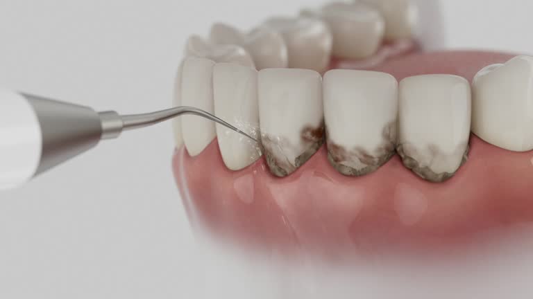 Trusted Root Canal Treatment service in Sorgho, KY - Dentist Open Now